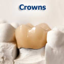 Crowns