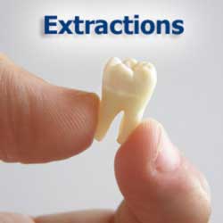 Extractions