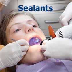 Sealants